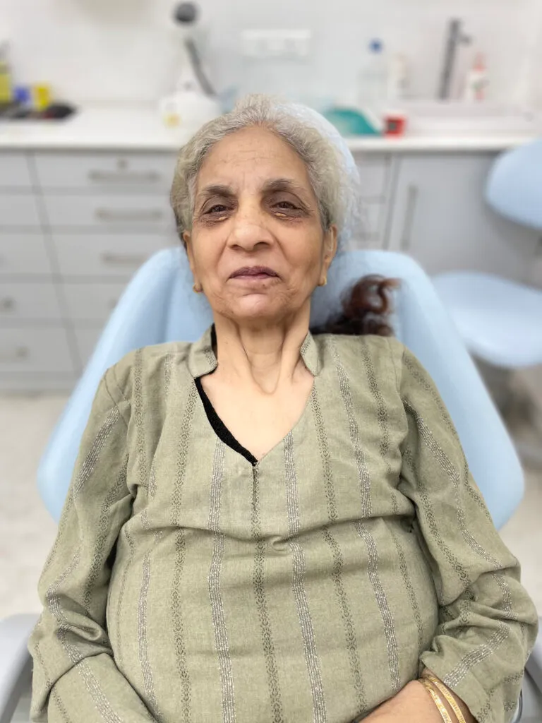 One Smile patient transformation 4