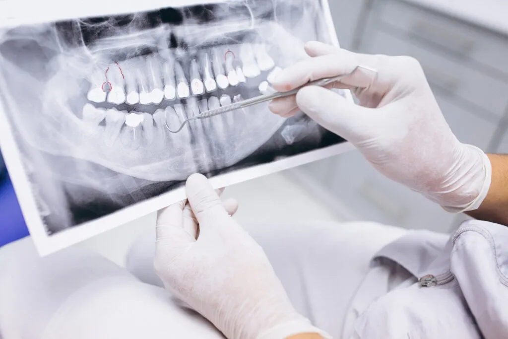 Braces & Clear Aligners