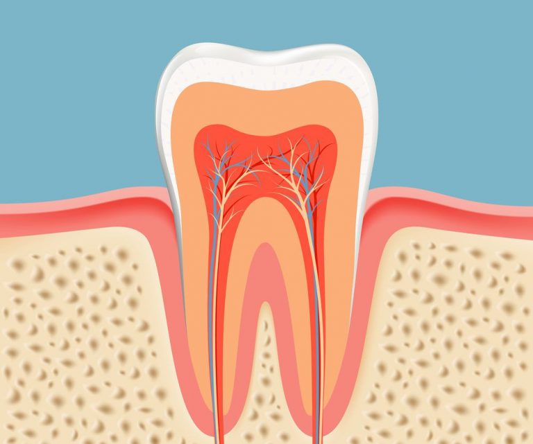 Root Canal Treatment